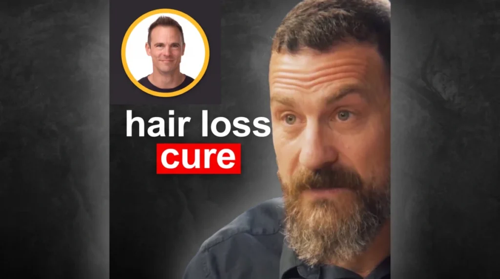 Modern Science Offers New Hope and Strategies in the Battle Against Hair Loss