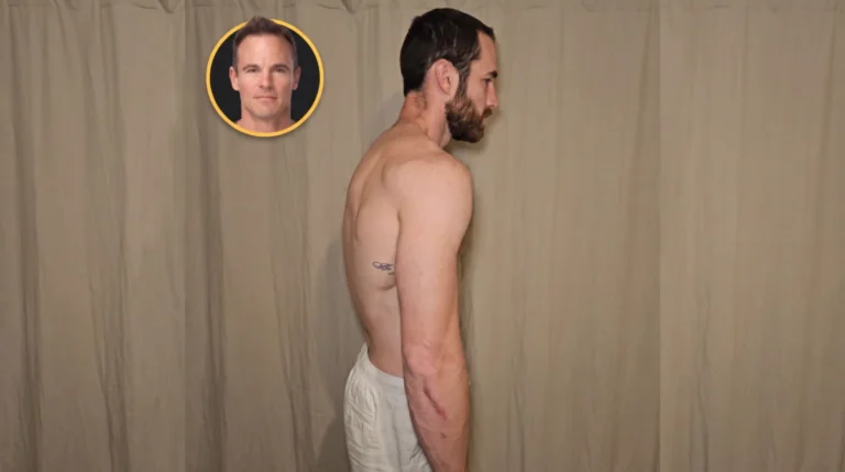 Why Pull-Ups and Dips Are Rounding Your Shoulders—and the Missing Movement Pattern That Fixes It